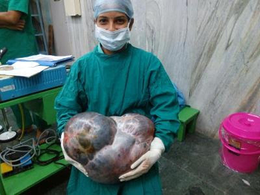 tumour